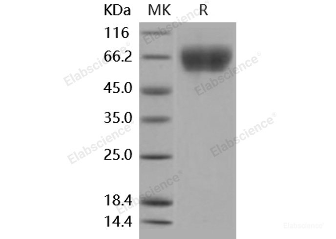 Recombinant Mouse FGFR3 / CD333 Protein (His tag)-Elabscience