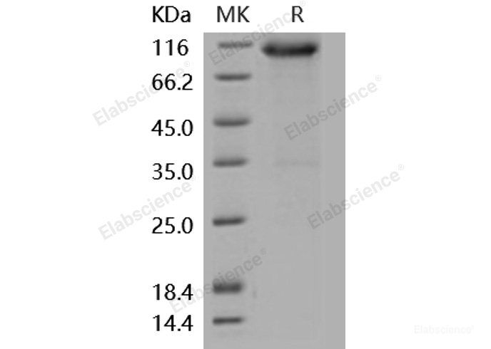 Recombinant Mouse FGFR3 / CD333 Protein (His & Fc tag)-Elabscience