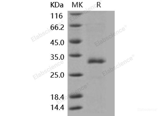 Recombinant Mouse MBL1 Protein (His tag)-Elabscience