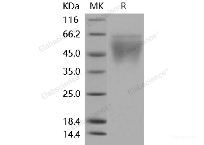 Recombinant Mouse CD86 / B7-2 Protein (His tag)-Elabscience