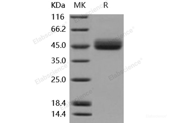 Recombinant Mouse IL13RA2 / CD213A2 Protein (His tag)-Elabscience