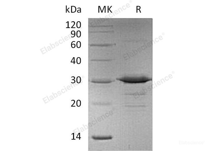 Recombinant Mouse Adiponectin/Acrp30/AdipoQ Protein(N-6His)-Elabscience