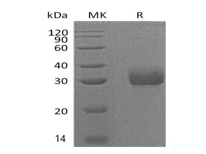 Recombinant Mouse Adiponectin/Acrp30/AdipoQ Protein(C-6His)-Elabscience