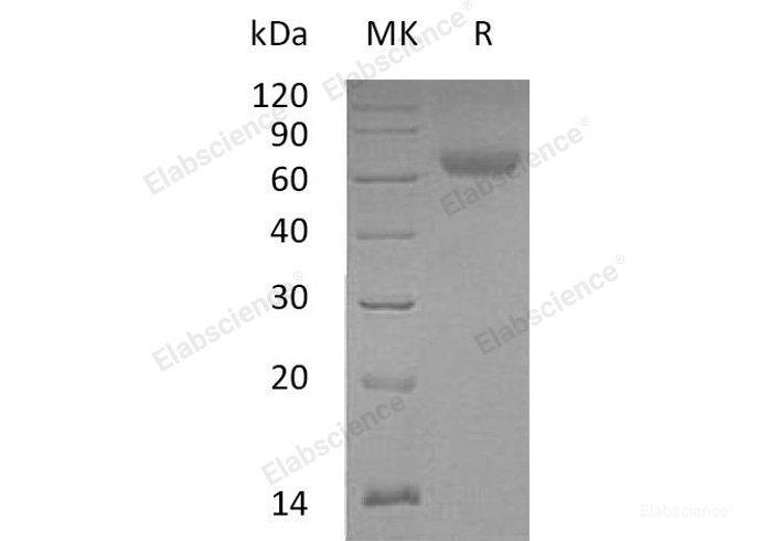 Recombinant Mouse Angiopoietin-Related Protein 4/ANGPTL4 Protein(C-Fc)-Elabscience