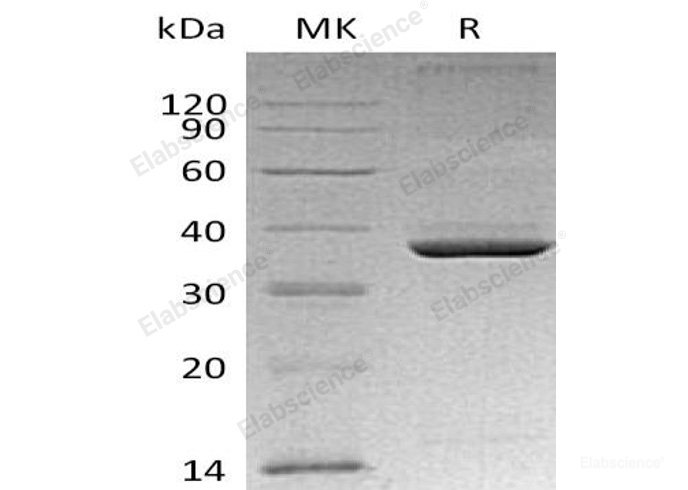 Recombinant Mouse Apolipoprotein E/ApoE Protein(C-6His)-Elabscience