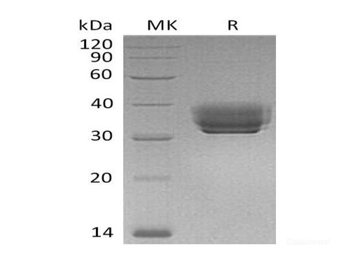 Recombinant Mouse Butyrophilin Subfamily 1 Member A1/BTN1A1 Protein(C-6His) -Elabscience