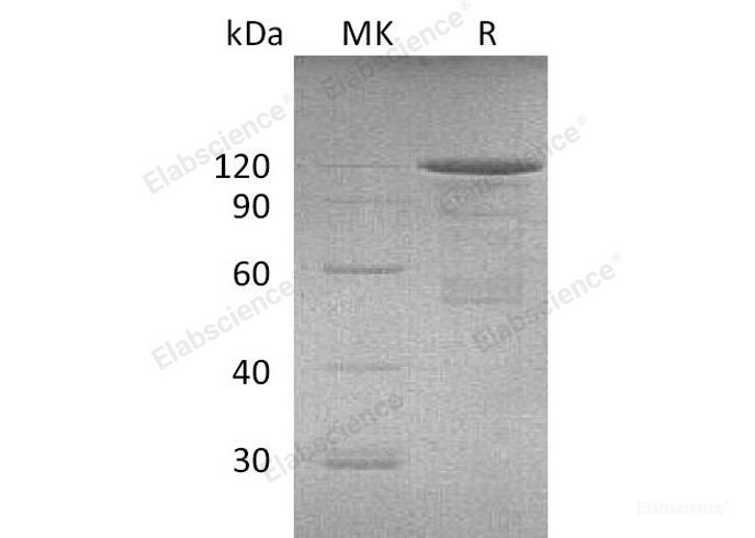 Recombinant Mouse Cadherin-3/P-Cadherin/CDH3 Protein(C-Fc) -Elabscience