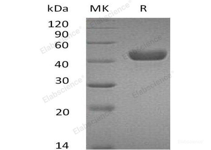 Recombinant Mouse Carbonic Anhydrase 14/CA14 Protein(C-6His)-Elabscience