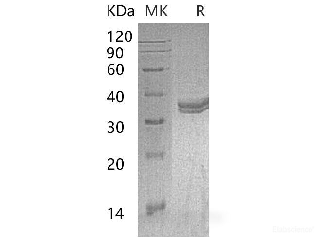 Recombinant Mouse Carbonic Anhydrase 4/CAIV/CA4 Protein(C-6His) -Elabscience