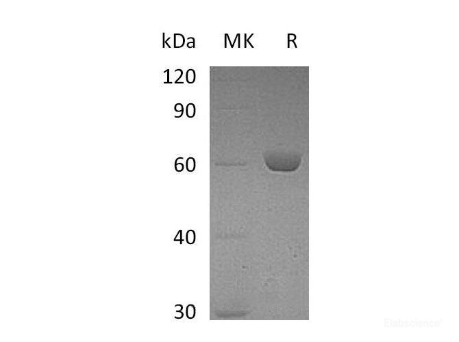 Recombinant Mouse Carboxylesterase 2E/CES2E Protein(C-6His) -Elabscience