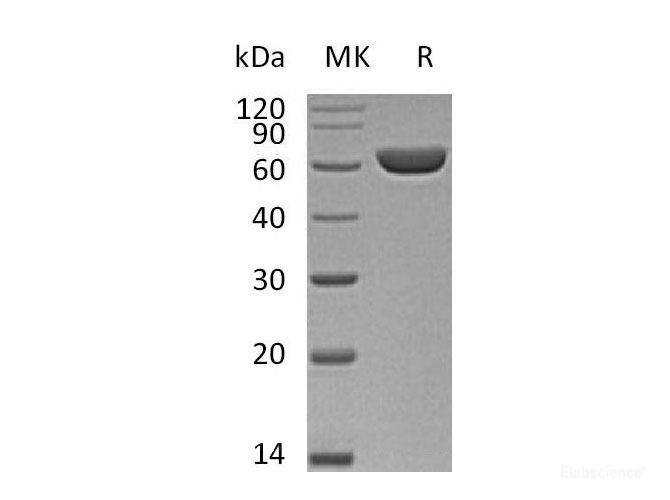Recombinant Mouse Carboxylesterase 3/CES3 Protein(C-6His) -Elabscience