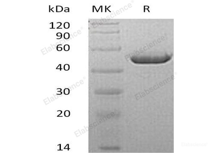 Recombinant Mouse Carboxypeptidase A4/CPA4 Protein(C-6His)-Elabscience