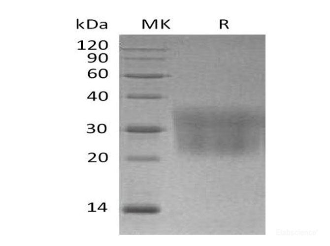Recombinant Mouse C-C motif chemokine 2/CCL2 Protein(C-6His) -Elabscience