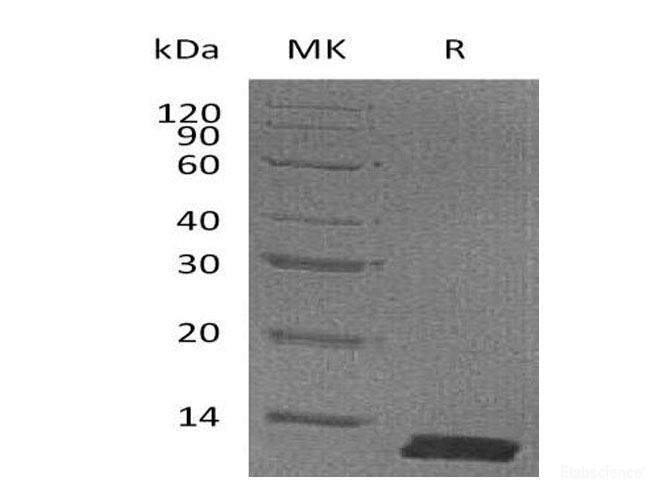 Recombinant Mouse C-C motif Chemokine 8/CCL8/MCP-2 Protein(C-6His) -Elabscience