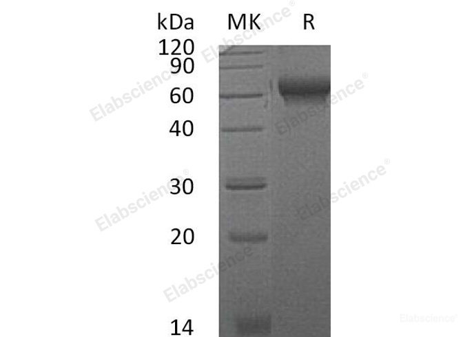 Recombinant Mouse Chordin-Like Protein 2/CHL2/CHRDL2 Protein(C-6His) -Elabscience