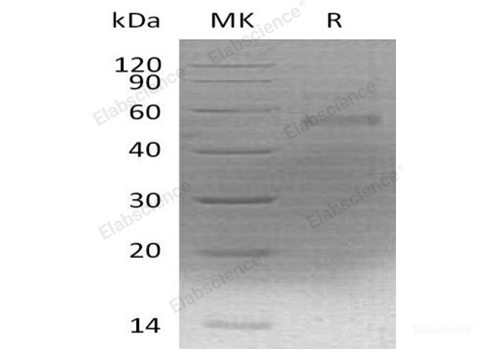Recombinant Mouse Coagulation Factor X/F10 Protein(C-6His)-Elabscience