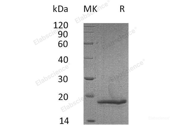 Recombinant Mouse Collagen Alpha-1(XVIII) Chain/EndostatinProtein(C-6His) -Elabscience