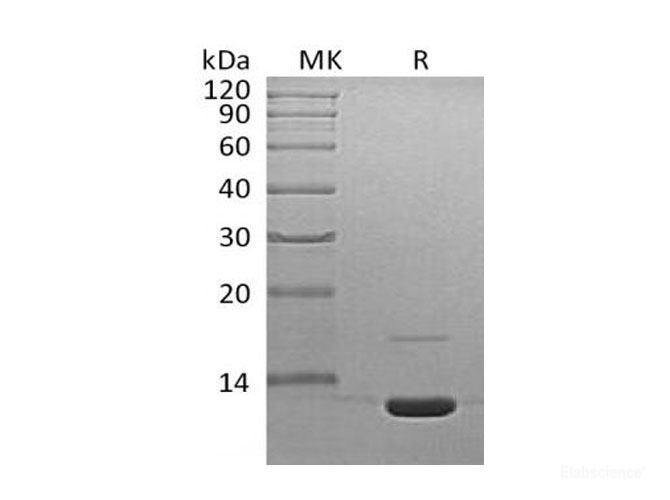 Recombinant Mouse Complement Component C3a/C3a Protein-Elabscience