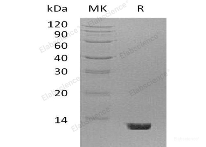 Recombinant Mouse Complement Component C5Protein-Elabscience