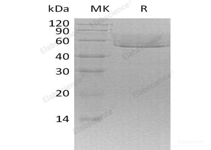 Recombinant Mouse C-X3-C Motif Chemokine 1/CX3CL1/Fractalkine Protein(C-6His)-Elabscience