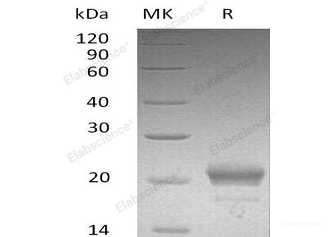 Recombinant Mouse C-X-C motif Chemokine 15/CXCL15/Lungkine Protein(C-6His)-Elabscience