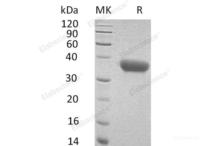 Recombinant Mouse C-X-C Motif Chemokine 16/CXCL16/SR-PSOX Protein(C-6His)-Elabscience