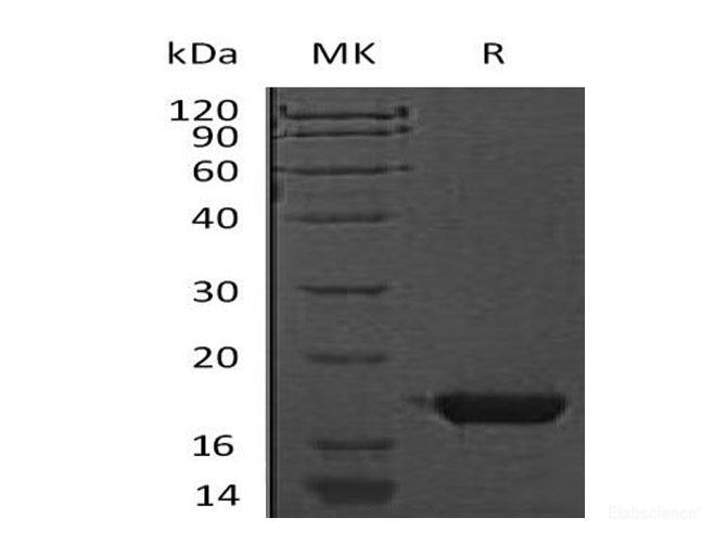 Recombinant Mouse Cystatin F/CST7 Protein(C-6His)-Elabscience