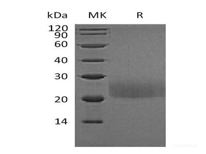 Recombinant Mouse Cytotoxic T-lymphocyte Protein 4Protein(C-Flag) -Elabscience