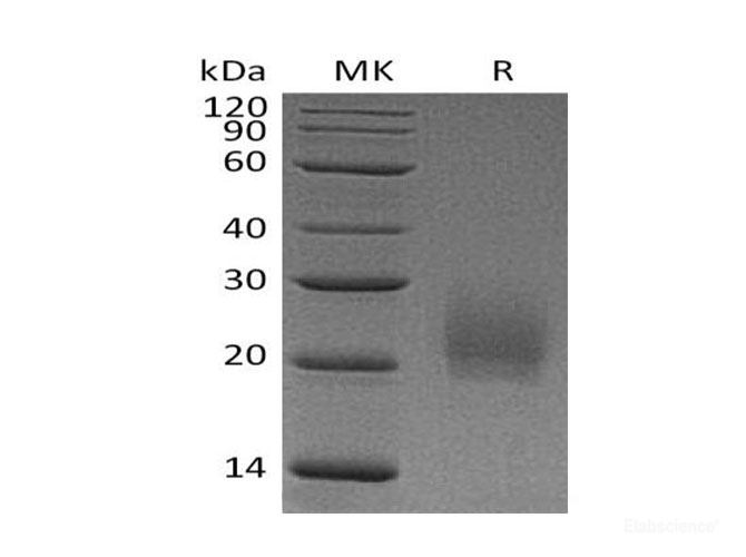 Recombinant Mouse Cytotoxic T-Lymphocyte Protein 4/CTLA-4/CD152 Protein(C-6His) -Elabscience