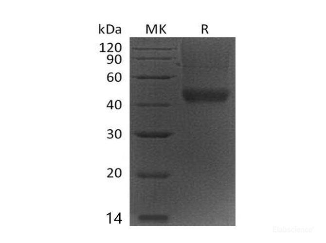 Recombinant Mouse Decorin/PGS2/PG40 Protein(C-6His) -Elabscience