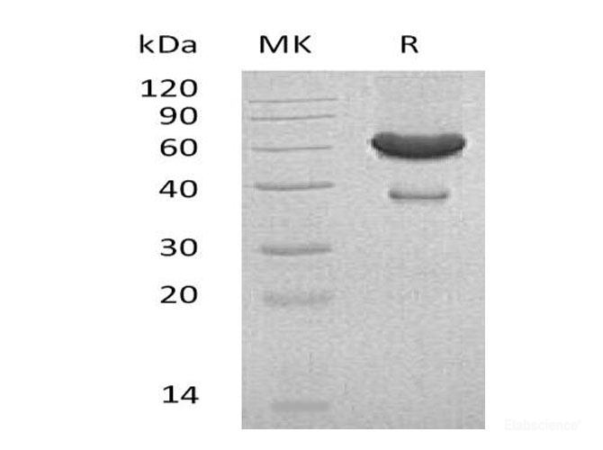 Recombinant Mouse Ephrin-A1/EFNA1 Protein(C-Fc-6His)-Elabscience