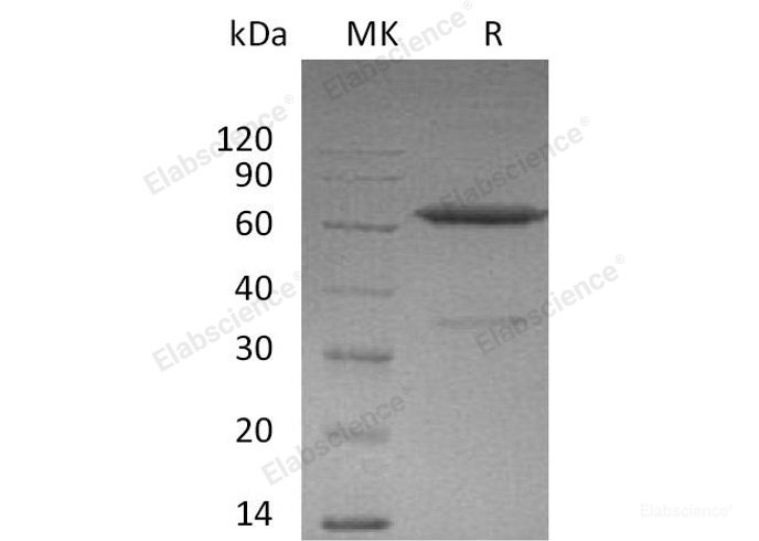Recombinant Mouse Ephrin-A3/EFNA3 Protein(C-Fc) -Elabscience