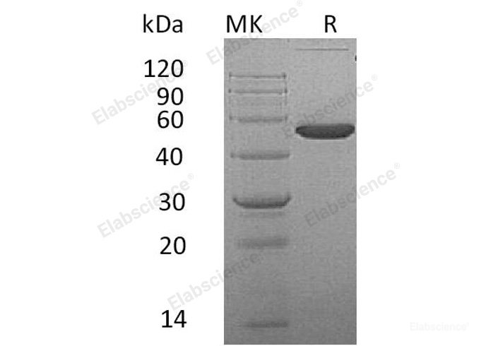 Recombinant Mouse Ephrin-A4/EFNA4 Protein(C-Fc)-Elabscience