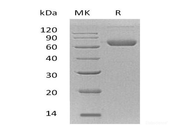 Recombinant Mouse Ephrin-B2/EFNB2 Protein(C-Fc-6His)-Elabscience