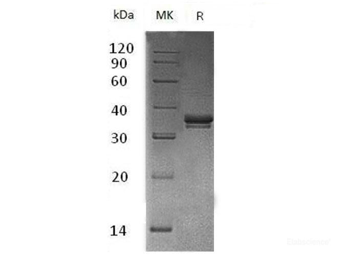 Recombinant Mouse Exostosin-Like 2/EXTL2 Protein(N-6His) -Elabscience