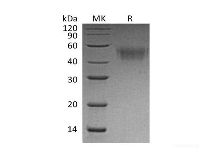 Recombinant Mouse Fc γ RI/FCGR1A/CD64 Protein(C-6His) -Elabscience