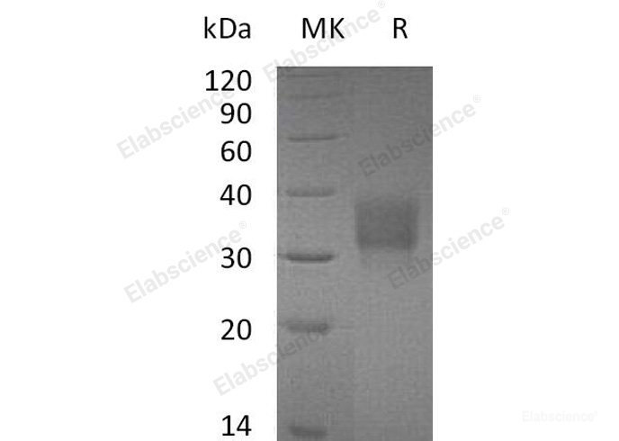 Recombinant Mouse Fc γ RII/CD32b/FCGR2 Protein(C-6His)-Elabscience