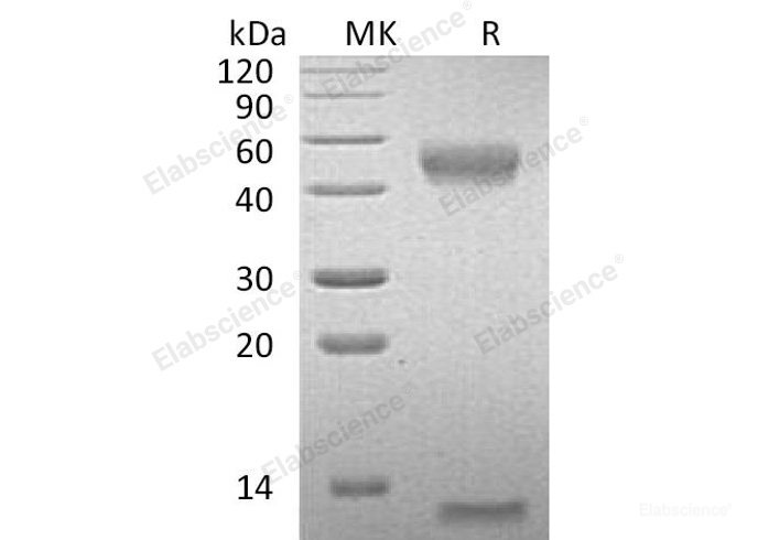 Recombinant Mouse FcRn & B2M Heterodimer Protein(C-6His) -Elabscience