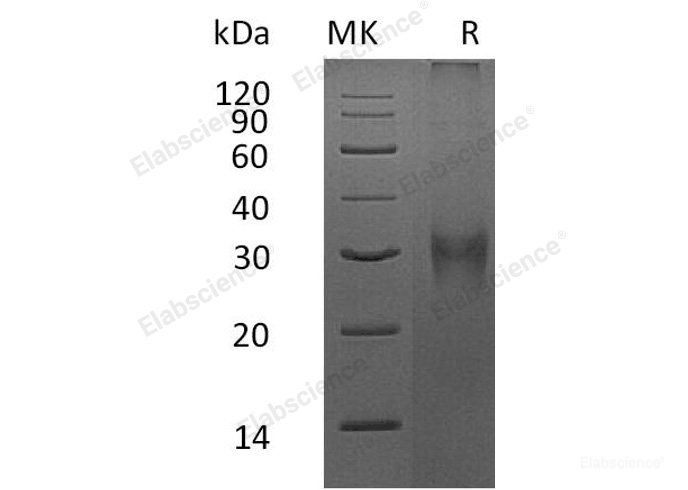 Recombinant Mouse Fibrillin-1/Asprosin Protein(N-8His) -Elabscience