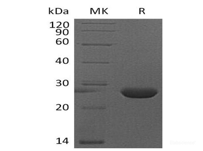 Recombinant Mouse Fibroblast Growth Factor 9/FGF-9Protein(C-6His) -Elabscience