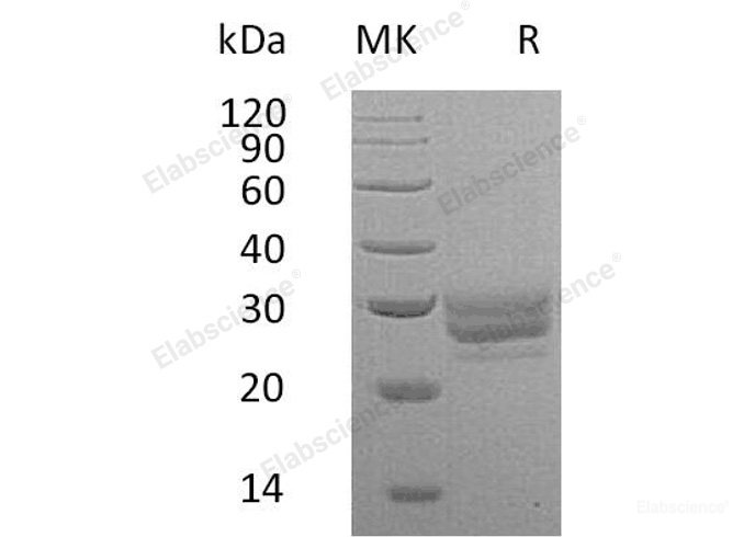 Recombinant Mouse Fms-LikeTyrosine Kinase 3 Ligand/FLT3LG Protein(C-6His) -Elabscience