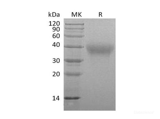 Recombinant Mouse Frizzled 1/FZD1 Protein(C-Fc) -Elabscience