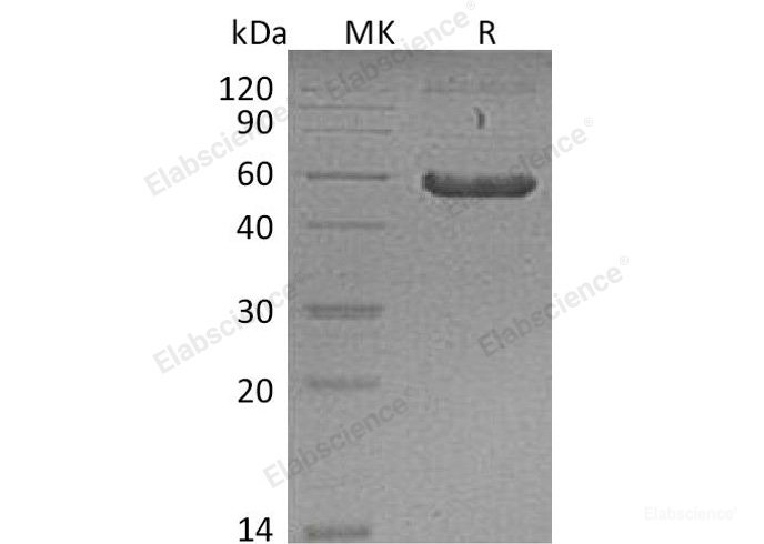 Recombinant Mouse Frizzled 2/FZD2 Protein(C-Fc) -Elabscience
