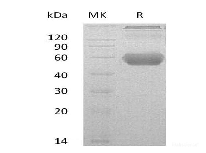 Recombinant Mouse GITR/TNFRSF18/CD357 Protein(C-Fc-6His)-Elabscience