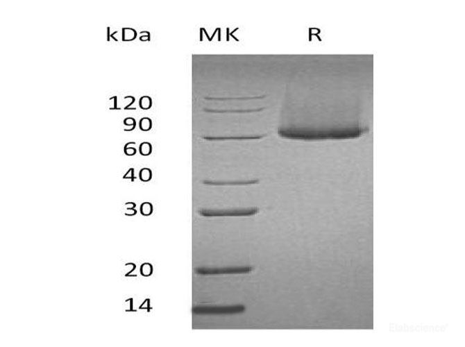 Quality Reliable Recombinant Mouse Glypican-1/GPC1 Protein (His