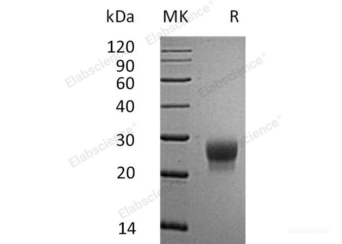 Recombinant Mouse Granulocyte Colony-Stimulating Factor/G-CSF/CSF1Protein(C-6His) -Elabscience
