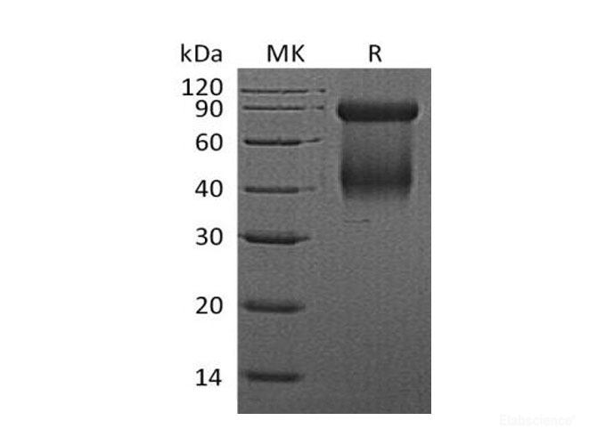 Recombinant Mouse Granzyme D/GZMD Protein(C-6His) -Elabscience