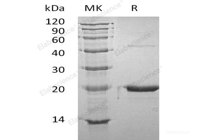 Recombinant Mouse Growth Hormone/GHProtein-Elabscience