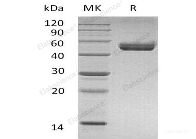 Recombinant Mouse HLADG/CD74 Protein(C-mFc-6His)-Elabscience