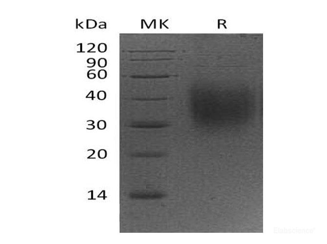 Recombinant Mouse IAP/OA3/CD47 Protein(C-6His) -Elabscience